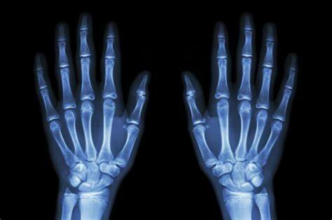 Descubrimiento de los rayos X