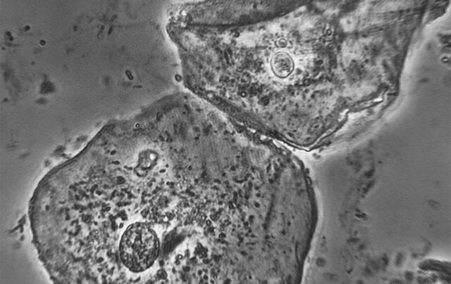 Frits Zernike: contraste de fases