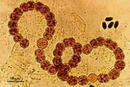 La teoría microbiana.