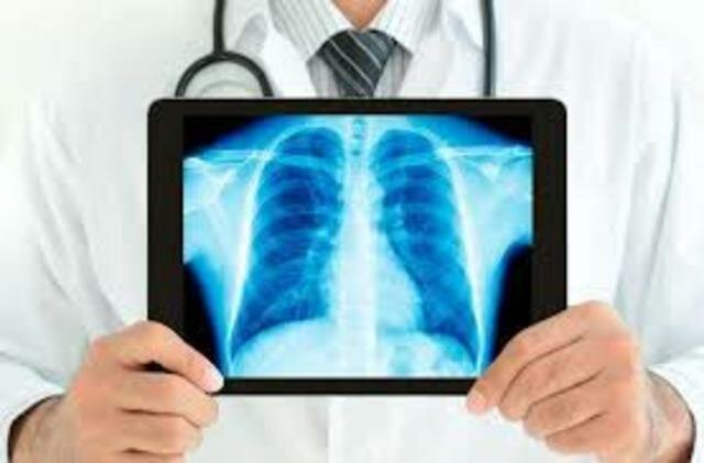 Tinta azul en la radiología