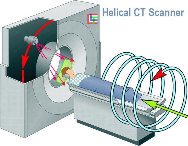 Se presenta la TC Helicoidal de 320 cortes (Toshiba)