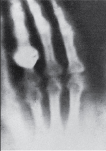 La producción y publicación de la primera imagen de Rayos X