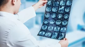 Timeline: Historia de la Radiología