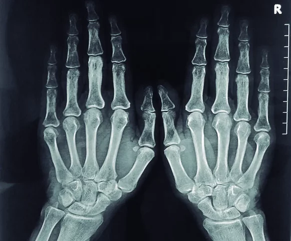 Se realizan las primeras aplicaciones médicas de los rayos X en el diagnóstico y tratamiento.