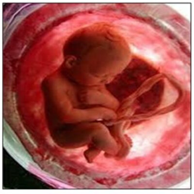 PERIODO FETAL