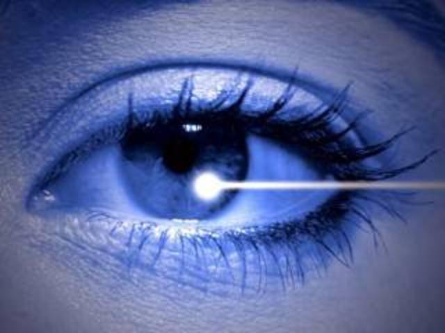 Operaciones en los ojos