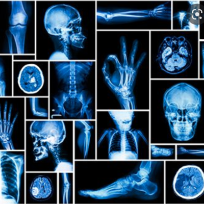 Timeline: Historia de la radiología