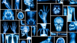 Timeline: Historia de la radiología