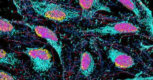 Descubrimiento de celulas HeLa