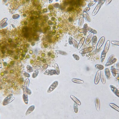 Timeline: Historia de la microbiología