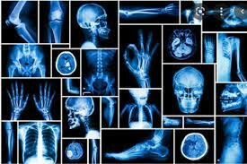 Magnitudes de protección radiológica