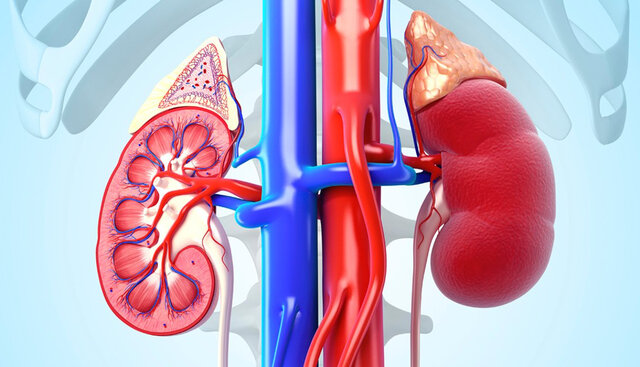 Creación del Primer Riñón Artificial