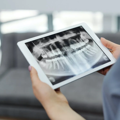 Timeline: Historia de la Radiologia