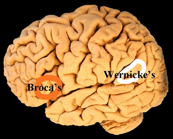 Broca's Area Identified