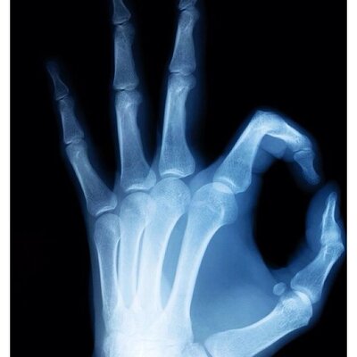 Timeline: Historia de la radiología