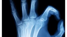 Timeline: Historia de la radiología