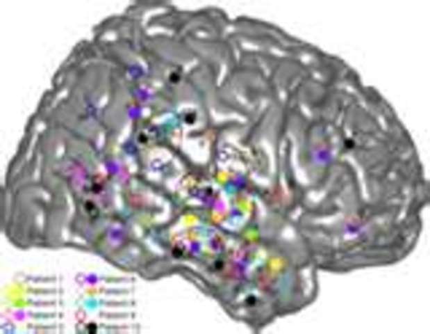 Allison et al Discover Left-hemisphere Preference for Words vs. Faces