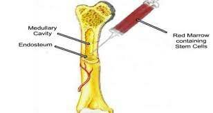 20th Century (continues)