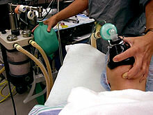 Anesthesia