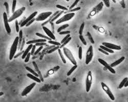 Aaislamiento de Clostridium