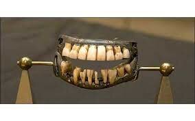 ¿Primera Prótesis Dental?