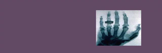 Descubrimiento de los rayos X por Wilhelm Roentgen