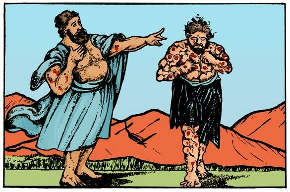 Levítico: primer código de higiene escrito