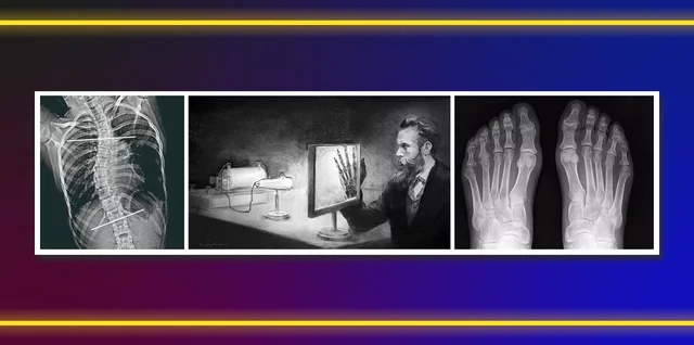 PRIMERA PUBLICACION DE RAYOS X