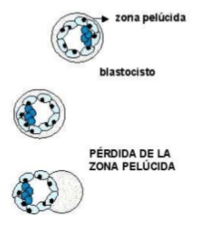 Eliminación de la zona pelúcida (Día 5)