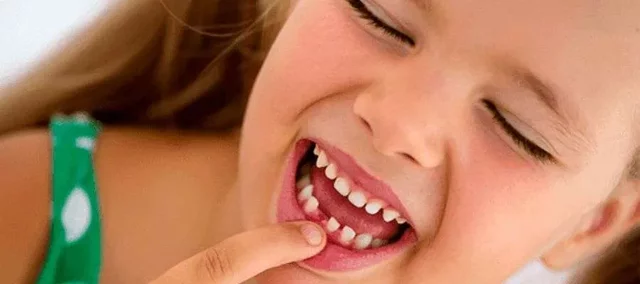 primera dent caiguda