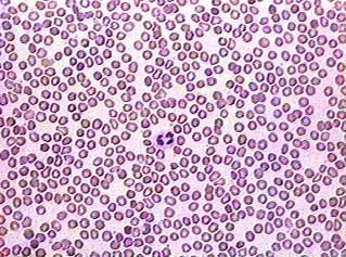 Anton van Leeuwenhoek viewed blood cells under a microscope