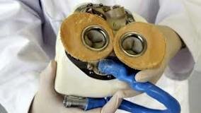 El primer Corazon artificial permanente