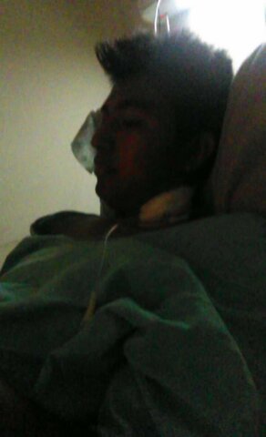 Alta de mi hermano después de la leucemia