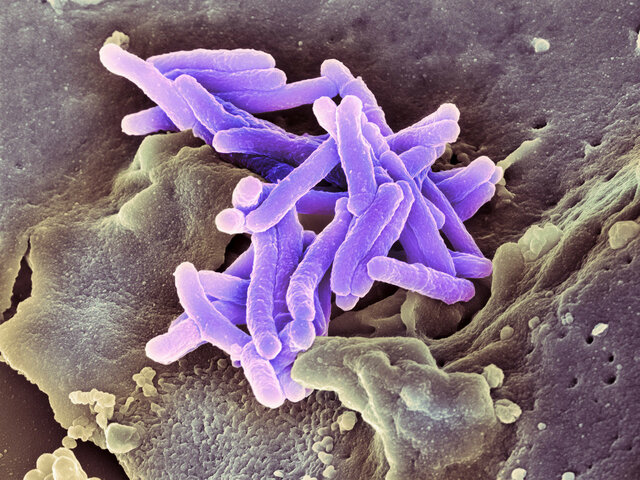 Koch: La tuberculosis