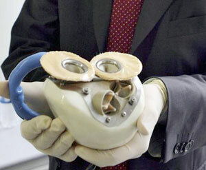 Primer trasplantament d'un cor artificial en un humà