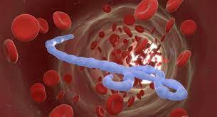 Crisi del virus d'Ebola