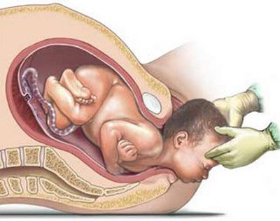 ETAPA PERINATAL