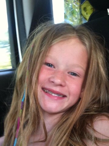 Got braces for the first time