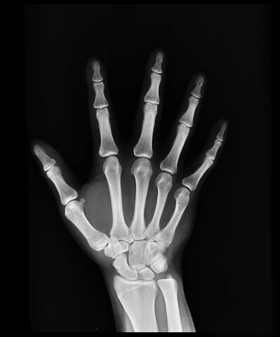 X-rays