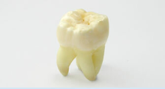 m'arrenquen la primera premolar