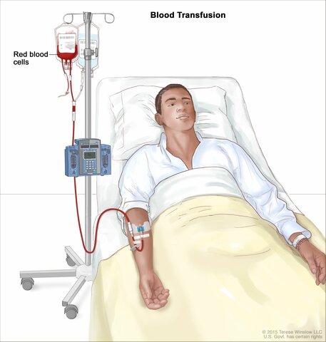 First blood transfusion performed