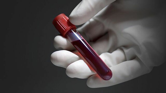 Scientists began developing blood-screening tests for infectious diseases