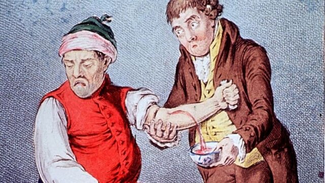 Egyptian Bloodletting