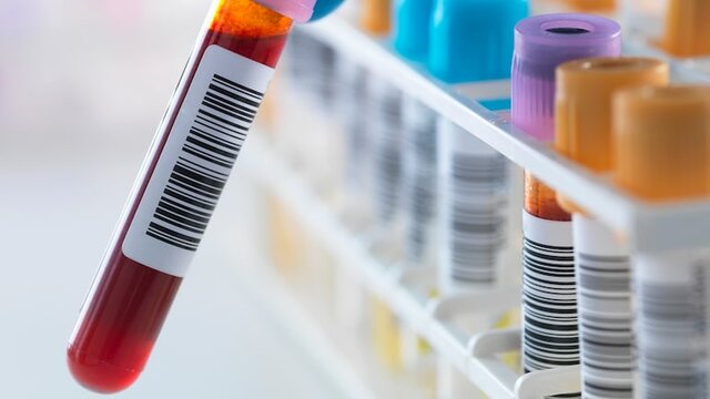 Blood Screening Tests