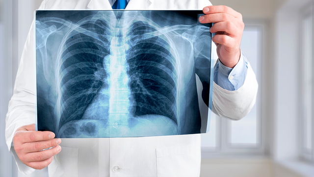 Descubrimiento de la radiología ( RAYOS X)