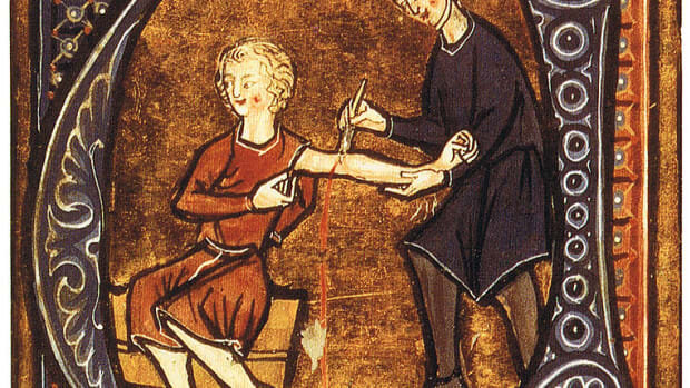 Egyptians used bloodletting to try to cure diseases