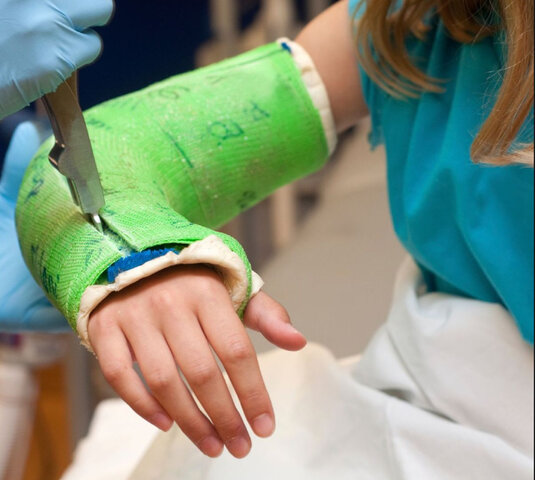 Erste mal Arm gebrochen