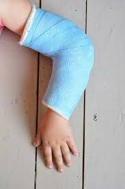 Em trenco la clavícula