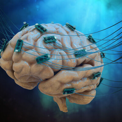 Timeline: ¿De donde viene el cerebro y para donde va ? La evolución del sistema nervioso