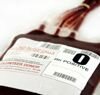 transfusion de sangre